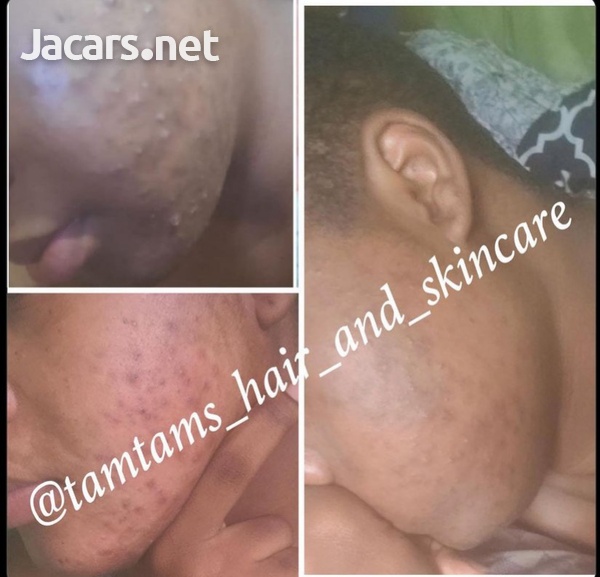 skincare products-3